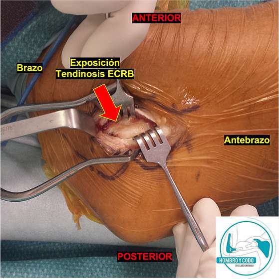 Fig 10b Epic Ab Exposic 1