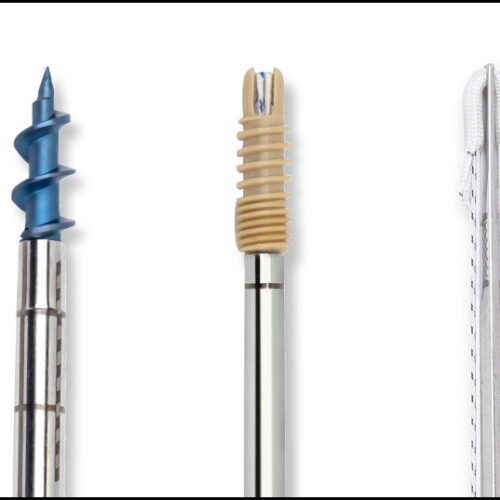 Blog #05: ¿Qué es un Ancla en Cirugía de Hombro y Codo?